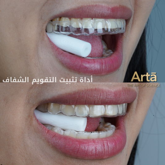 Arta clear aligner chewie tool | أداة آرتا لتثبيت التقويم الشفاف تعزز ثبات التقويم وتسرع النتائج لضغط مثالي وراحة فائقة أثناء الاستخدام اليومي