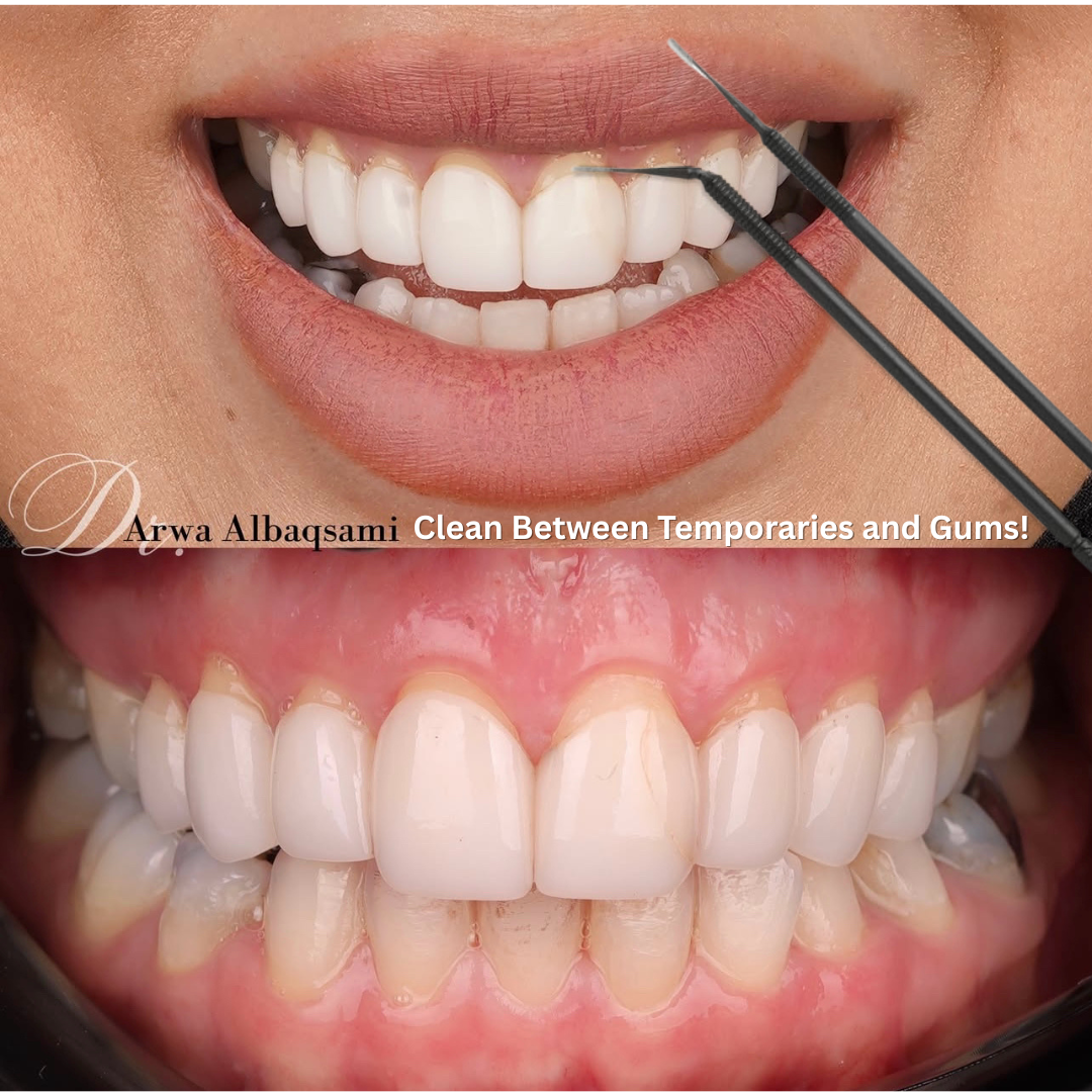 Disposable Microapplicators